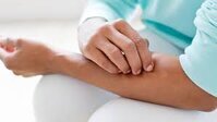 Psoriasis Psoriasis et magnétisme
