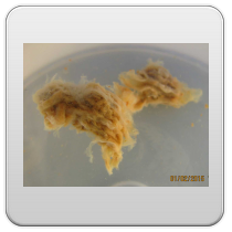 limpieza-de-los-intestinos-foto-11 limpieza de los intestinos foto 11