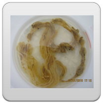 limpieza-de-los-intestinos-foto-1 limpieza de los intestinos foto 1