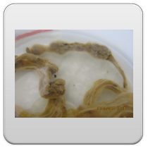 limpieza-de-los-intestinos-foto-4 limpieza de los intestinos foto 4