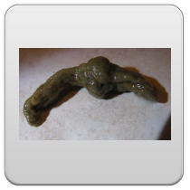 limpieza-de-los-intestinos-foto-7 limpieza de los intestinos foto 7