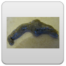 limpieza-de-los-intestinos-foto-8 limpieza de los intestinos foto 8