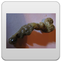 limpieza-de-los-intestinos-foto-9 limpieza de los intestinos foto 9